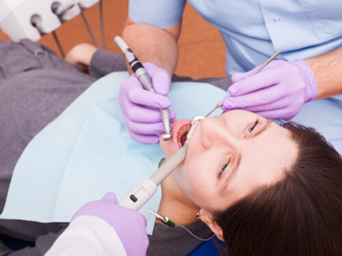 Root Canals vs. Extractions in Angus: Which is Right for You?