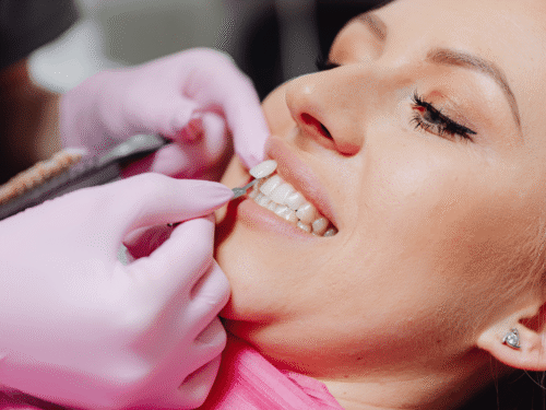 More Than Just White: How Teeth Whitening Can Truly “Improve Your Smile”