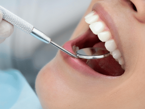 Mobility and Accessibility: Accessing Emergency Dental Care Services Across Angus