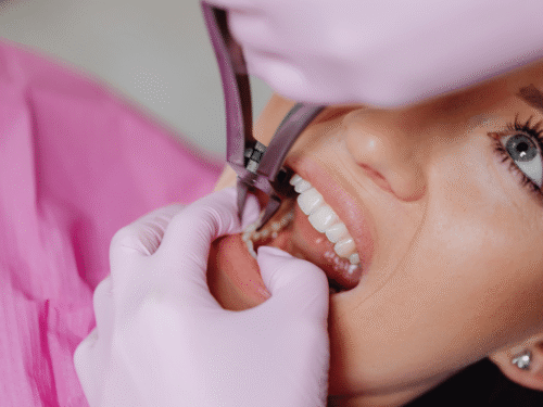 Root Canal Treatment vs. Tooth Extraction: Why Saving Your Natural Tooth is Always Best