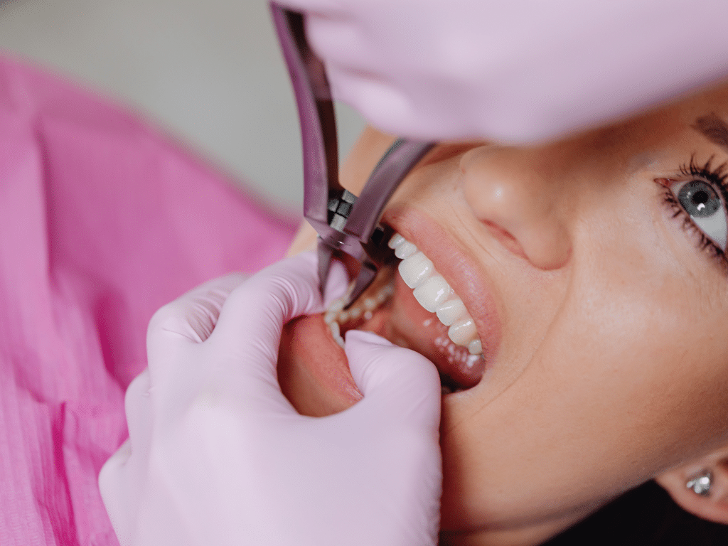 Root Canal Treatment vs. Tooth Extraction Why Saving Your Natural Tooth is Always Best