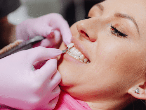 Bioclear vs. Porcelain Veneers: Which Smile Makeover Option Is Right for You?
