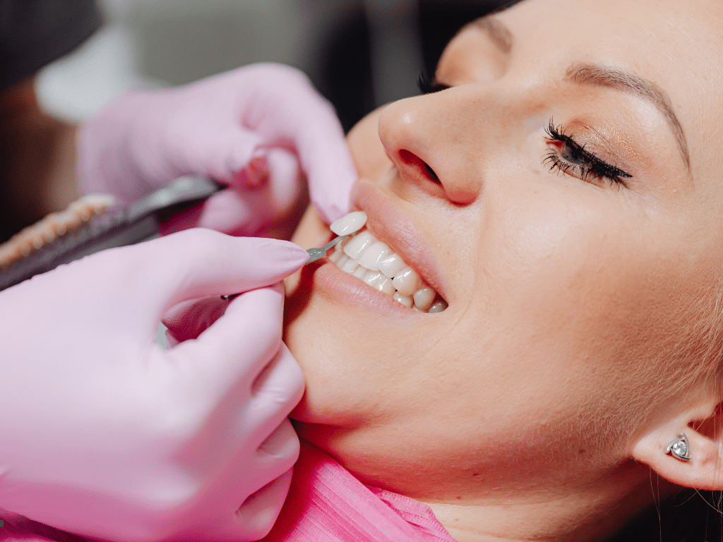 Bioclear vs. Porcelain Veneers