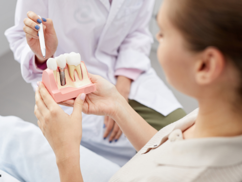 The Step-by-Step Dental Implant Journey: From Initial Consultation to Final Restoration